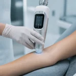 Épilation laser douleur : pièce à main médicale sur peau, cabinet.
