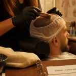 Greffe de cheveux coloration : coiffeuse prépare la teinture avant délai